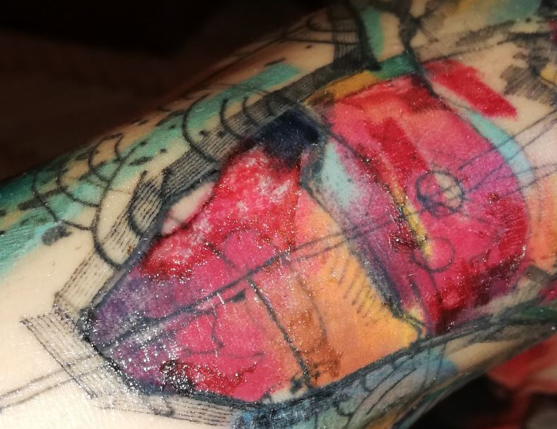 tattoo infection