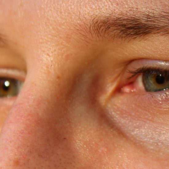 femto-lasik-laser-eye-surgery