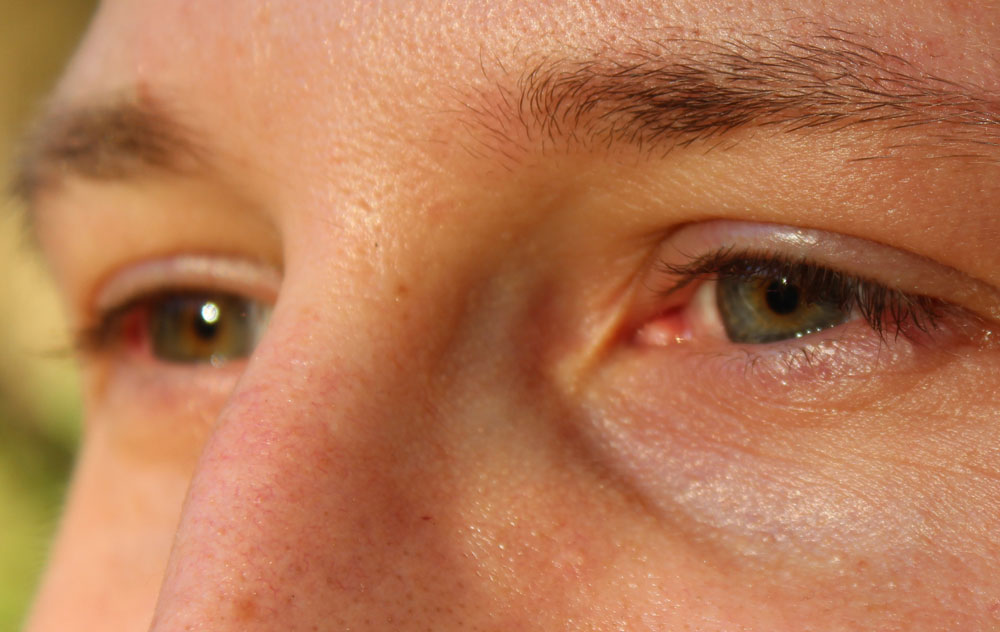femto-lasik-laser-eye-surgery